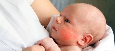 Huidverzorging in de zomer: zo pak je dat aan volgens dermatoloog Elodie Mendels