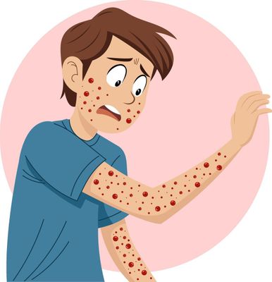 Allergy