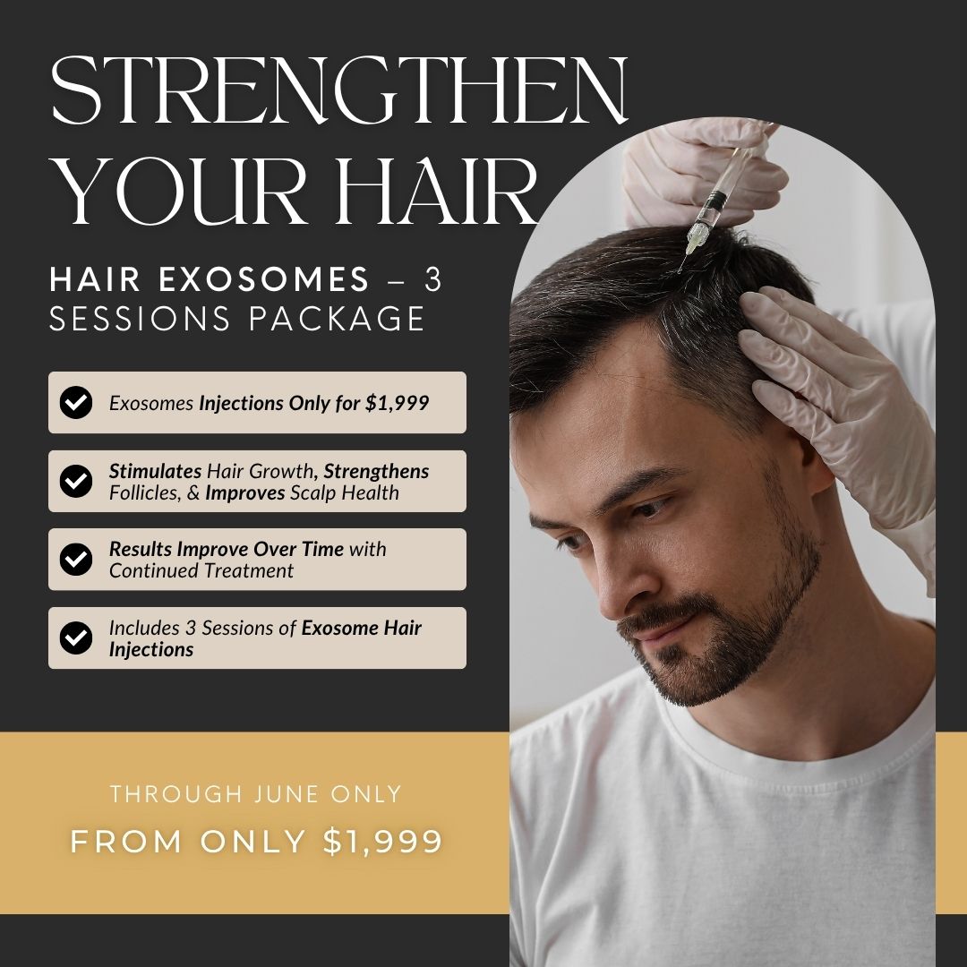 Hair Restoration w/ Exosomes | Series of 3 Treatments
