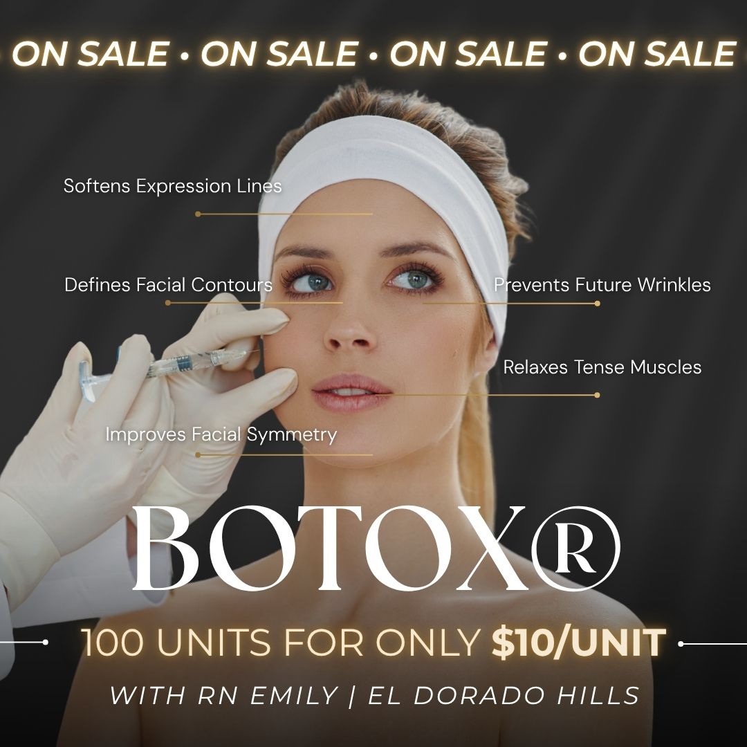 Botox® | $10/Unit Banks with Nurse Emily