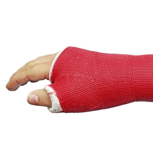 Custom Thermoplastic Cast
