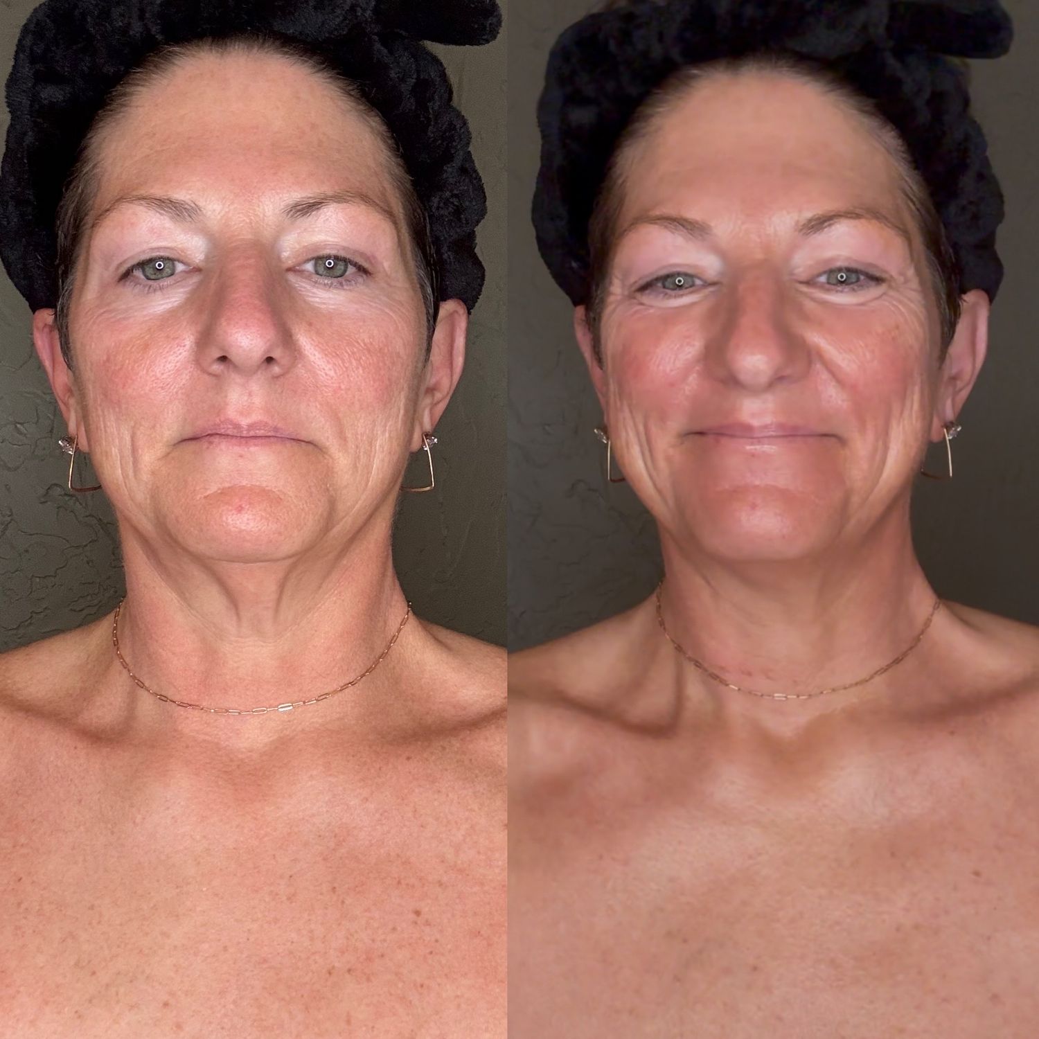 Sunless Tanner  -Sunright-