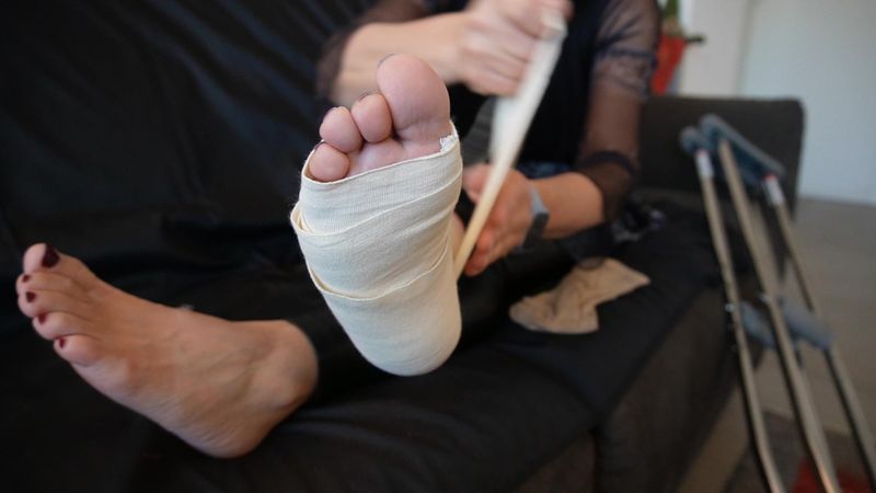 Samantha "Sprained Ankle & wedges"