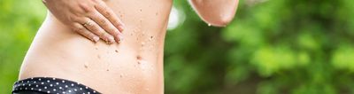 Exfoliants