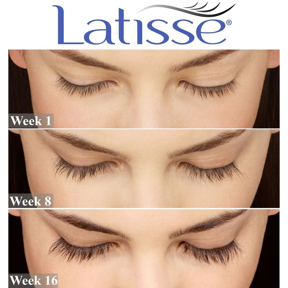 LATISSE Eyelash Lengthening and Thickening Serum - 5mL bottle (6 month supply)