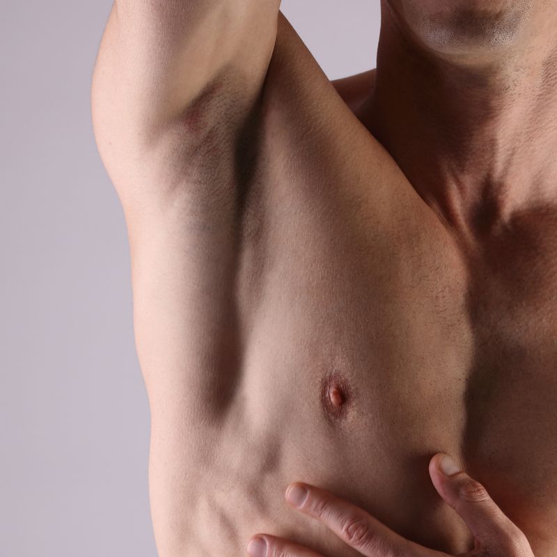 7 zabiegów epilacji laserowej PACHY | MĘŻCZYŹNI