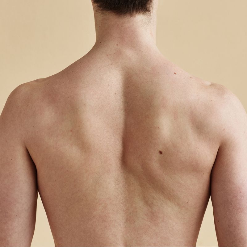 7 zabiegów epilacji laserowej PLECY + KARK | MĘŻCZYŹNI