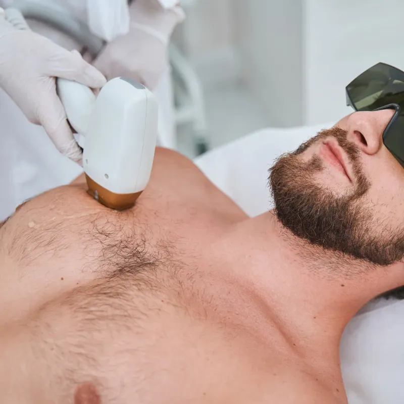 KLATKA PIERSIOWA | Depilacja LASEREM