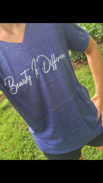 Beauty Is Difference