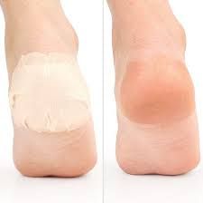 Heel Patch  Forit