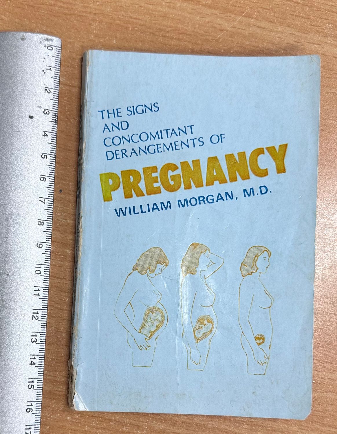 The Signs and Concomitant Derangement's of Pregnancy* (Morgan)