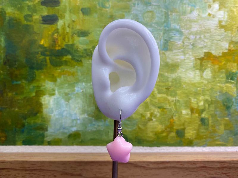 Arete estrella