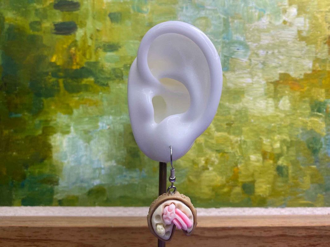 Arete pastel