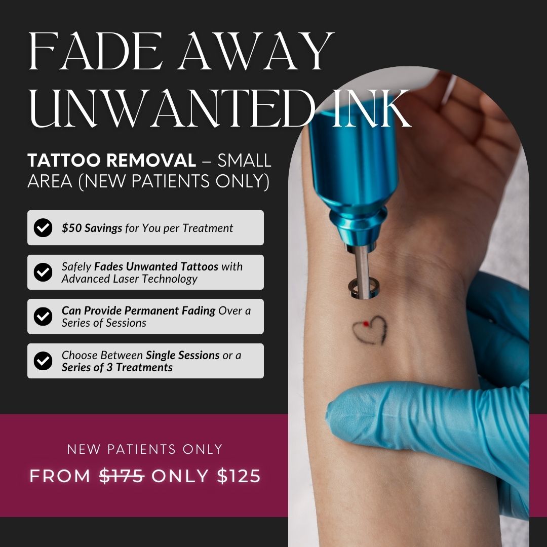 Tattoo Removal | Small Area Single Sessions &amp; Package Savings