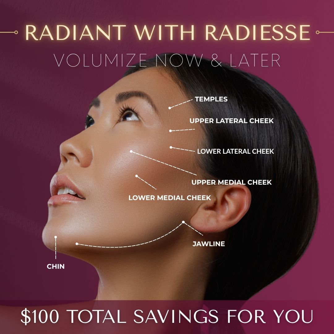 Radiesse® | $100 OFF Every Syringe