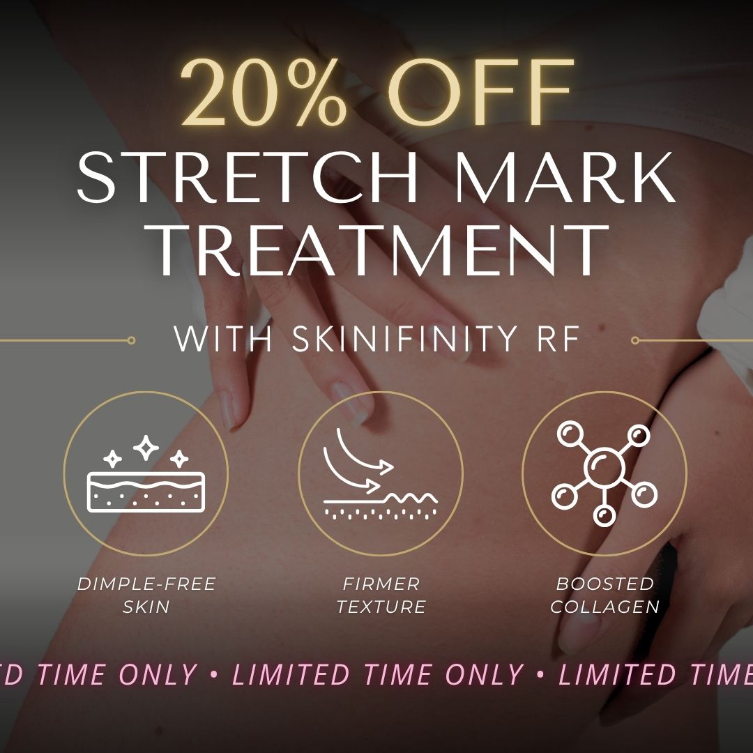 Skinfinity Stretch Mark Treatment | Buy 4 Sessions, Get 1 FREE!