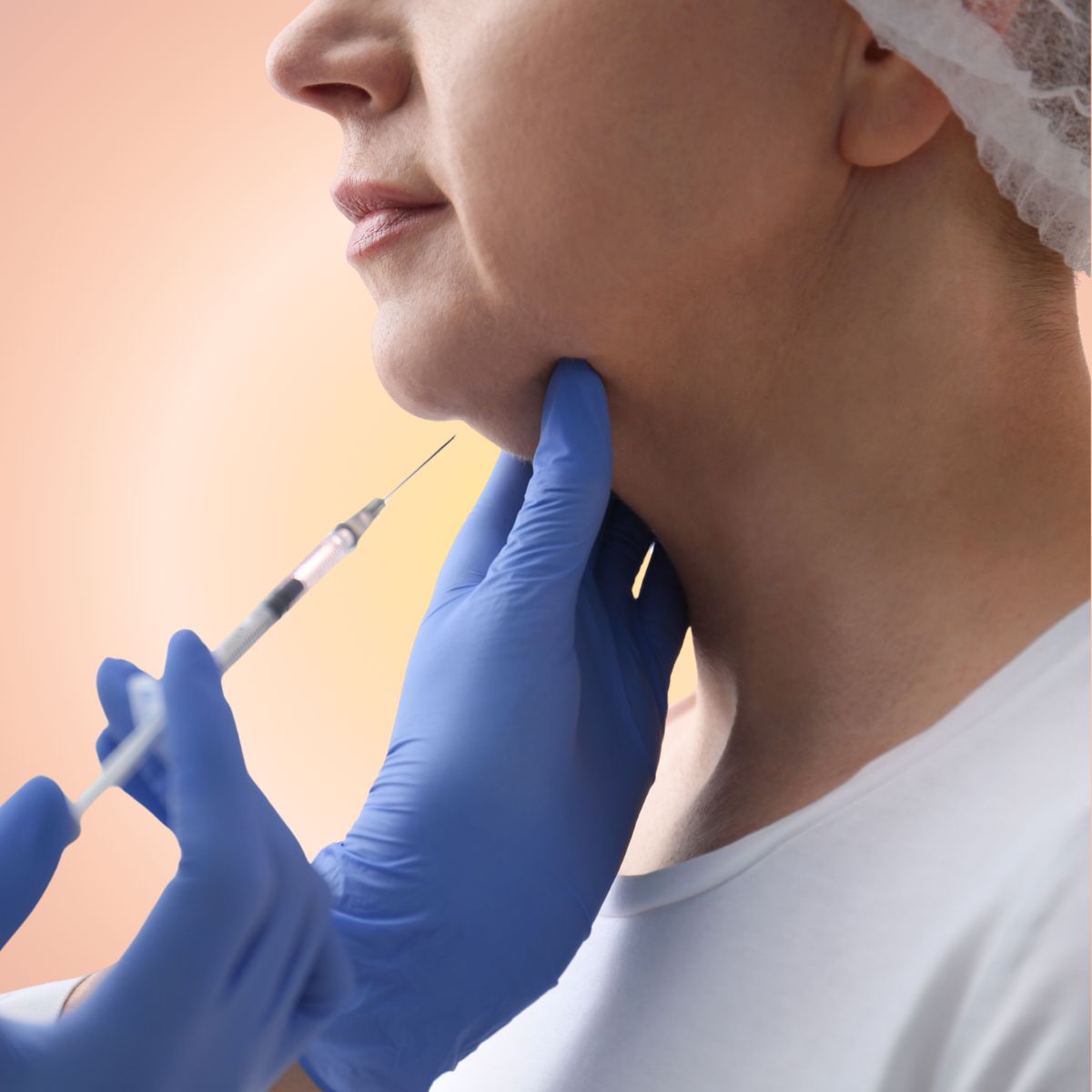 Kybella (Double-Chin Fat Reduction)