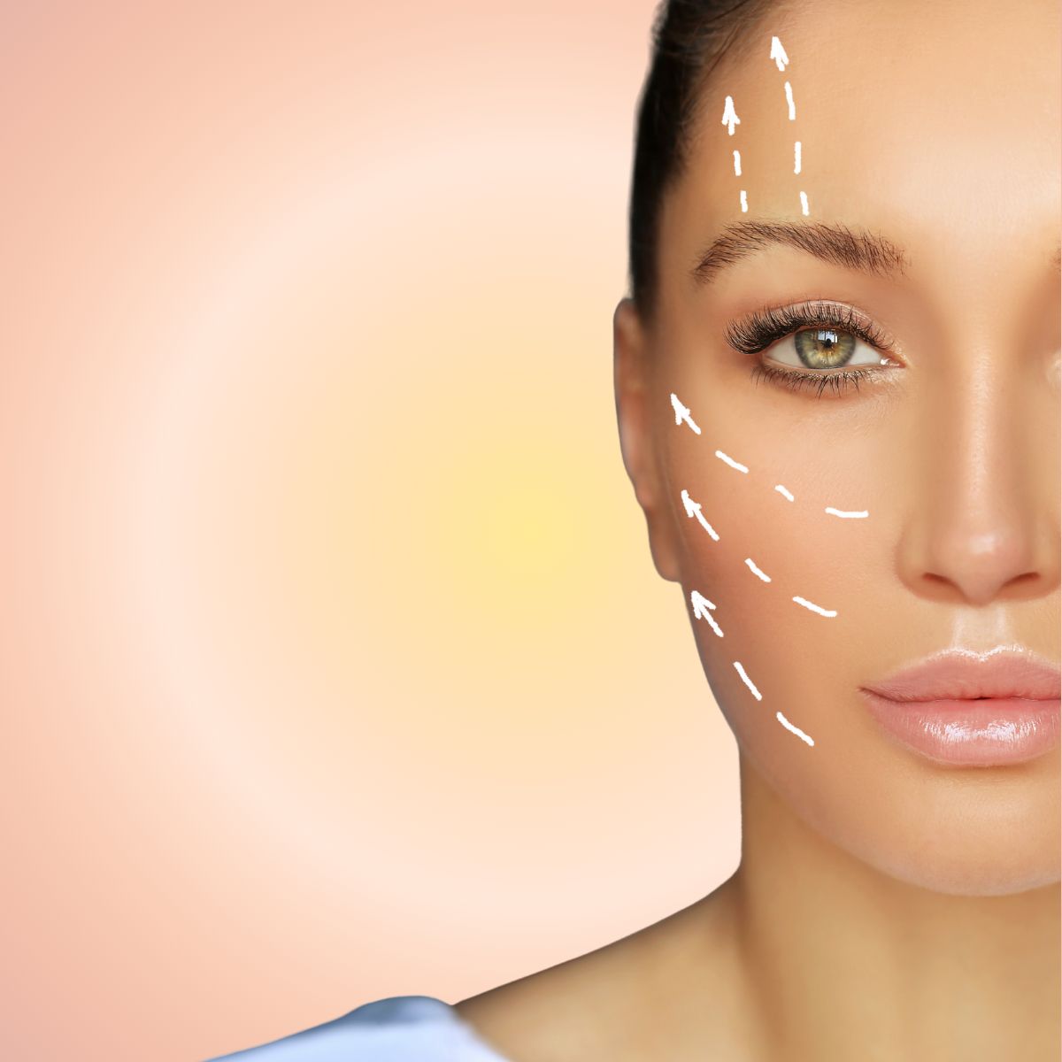 PDO Thread Lift – Non-Surgical Face &amp; Neck Lift