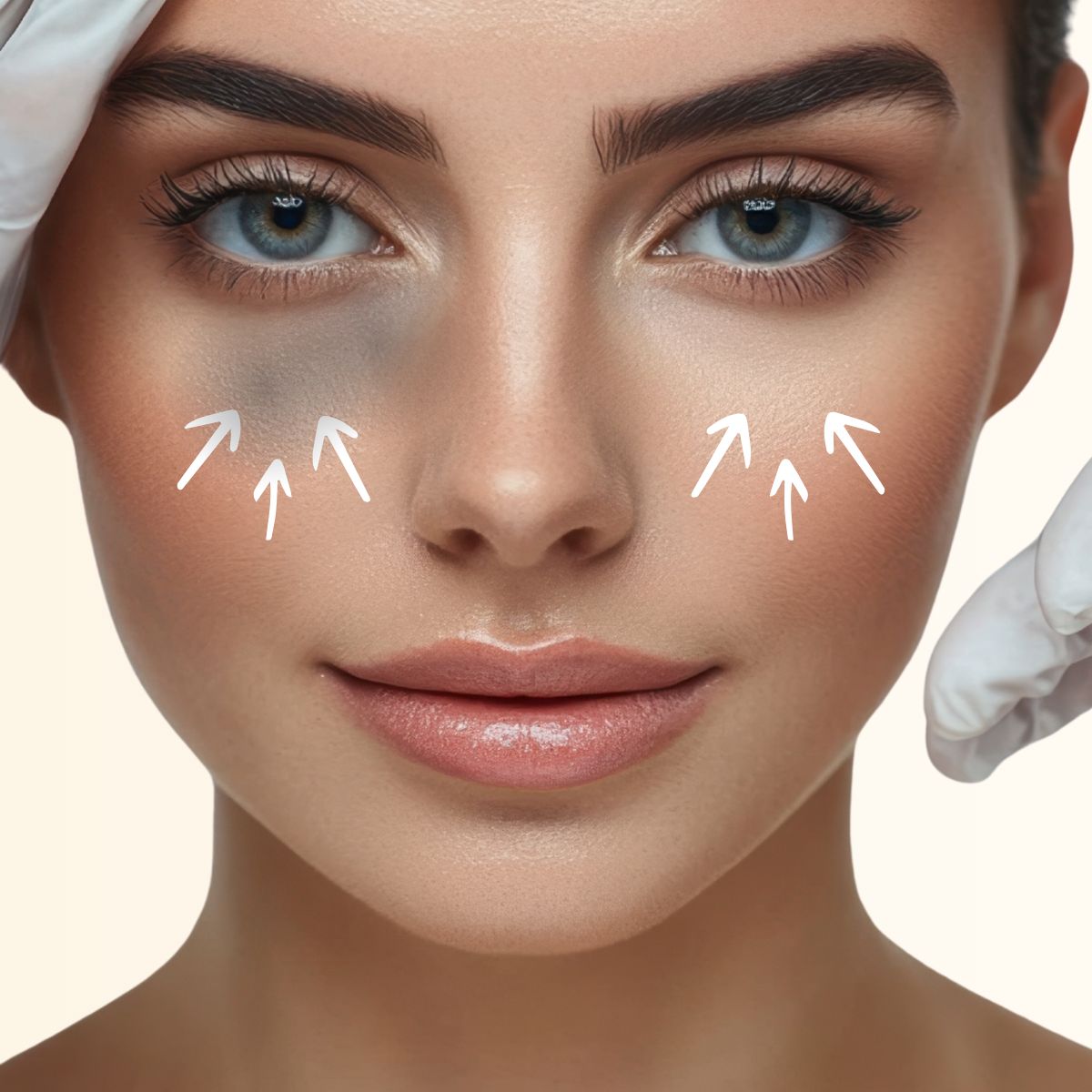 PRP Under-Eye Rejuvenation (Fall Bright Eyes Special)