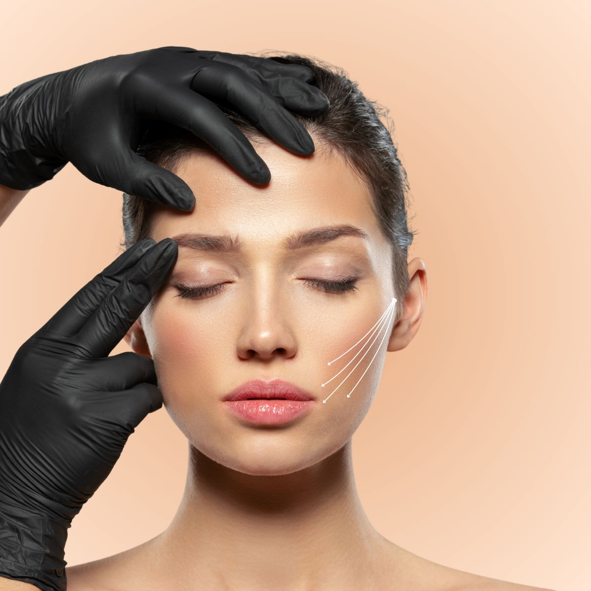 PDO Thread Lift – Non-Surgical Face &amp; Neck Lift