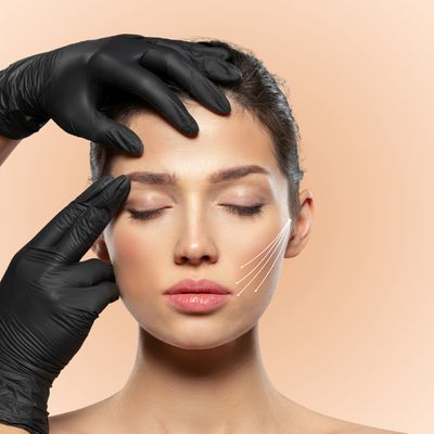 PDO Thread Lift – Non-Surgical Face &amp; Neck Lift
