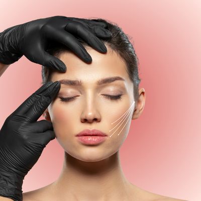 PDO Thread Lift – Non-Surgical Face &amp; Neck Lift