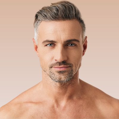 BOTOX® Cosmetic – Wrinkle Relaxer Treatment BOTOX® Cosmetic – Wrinkle Relaxer Treatment
