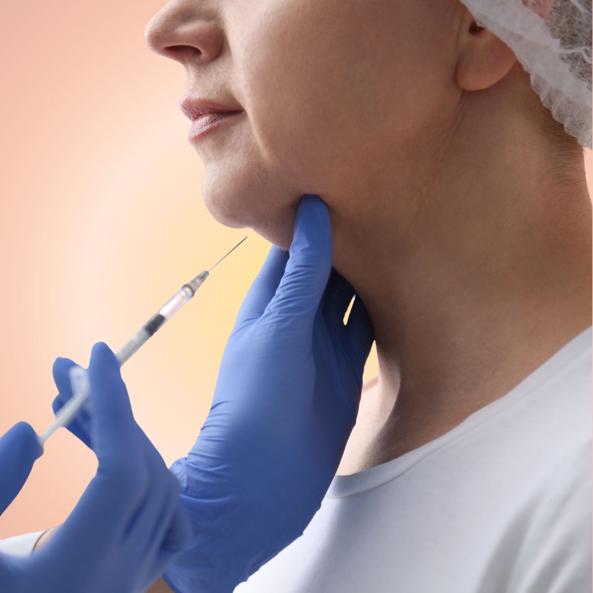 Kybella (Double-Chin Fat Reduction)