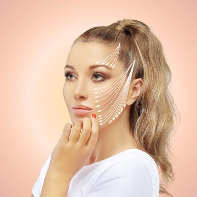 PDO Thread Lift – Non-Surgical Face &amp; Neck Lift