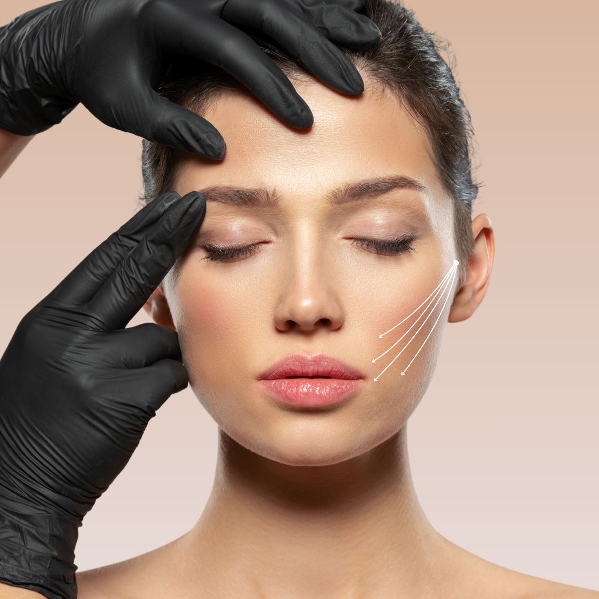PDO Thread Lift – Non-Surgical Face &amp; Neck Lift