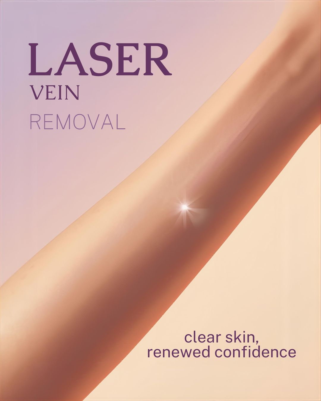 Laser Vein Removal