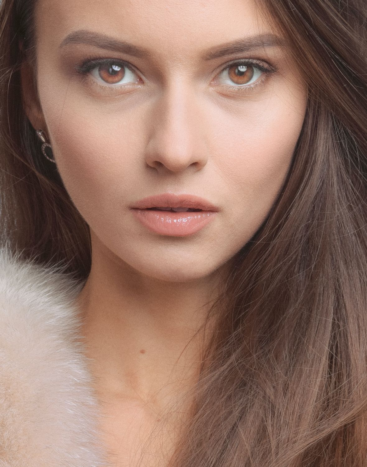 Dermal Filler:  $595.00