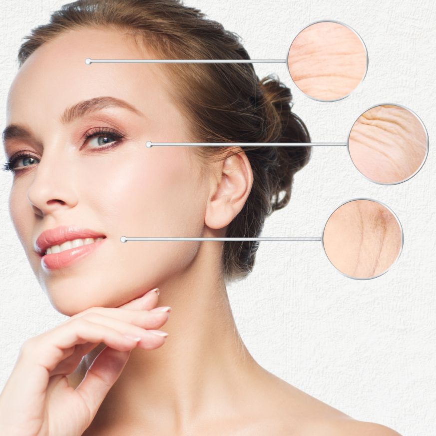 Exion RF Microneedling:  $675.00