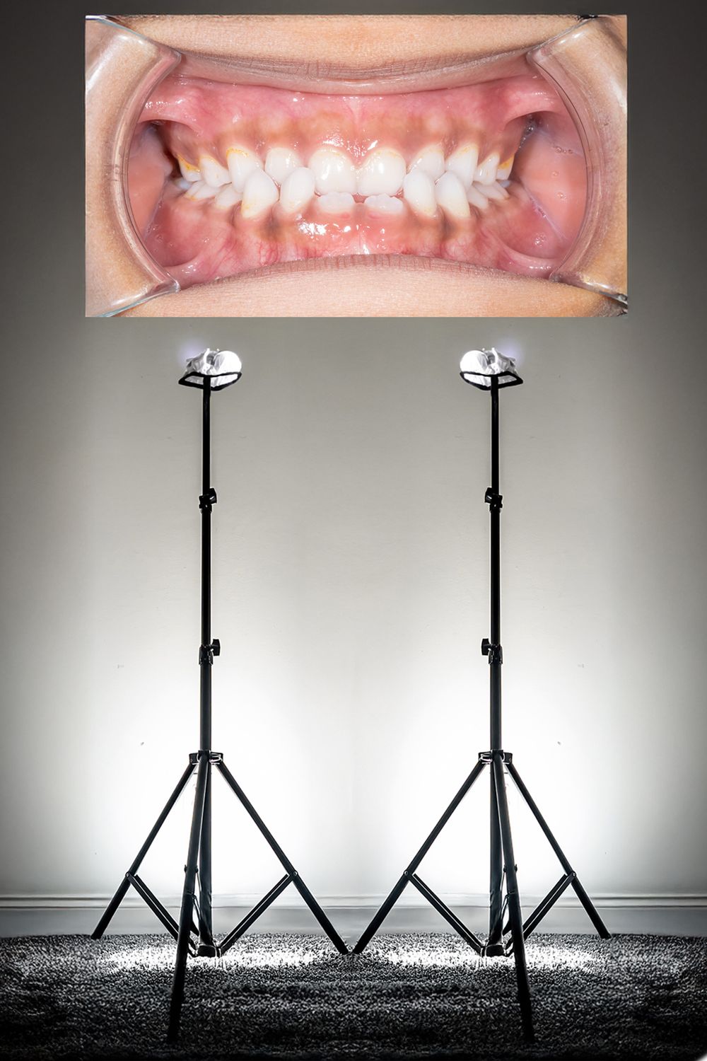 2 light sticks to light up before and after Dental Patients
