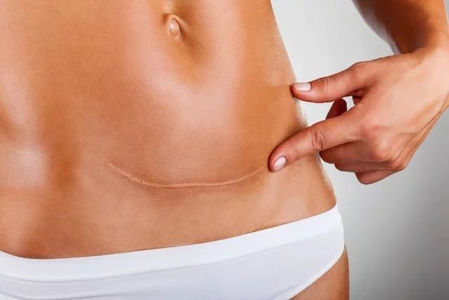 Masaje LILIUM BODY Post-Parto
