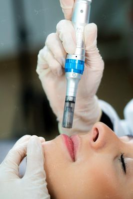 DERMAPEN LABIOS ( Acido Hialuronico ) DERMAPEN LABIOS ( Acido Hialuronico )