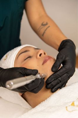 DERMAPEN FACIAL