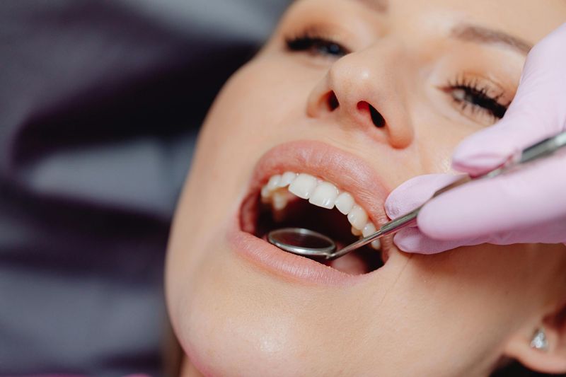 Consulta Diagnóstica - Periodoncia