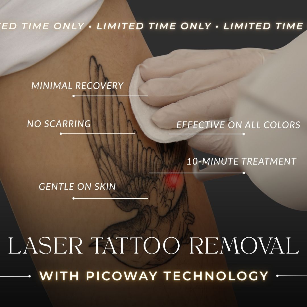 Laser Tattoo Removal | 1st Inch Treatment
