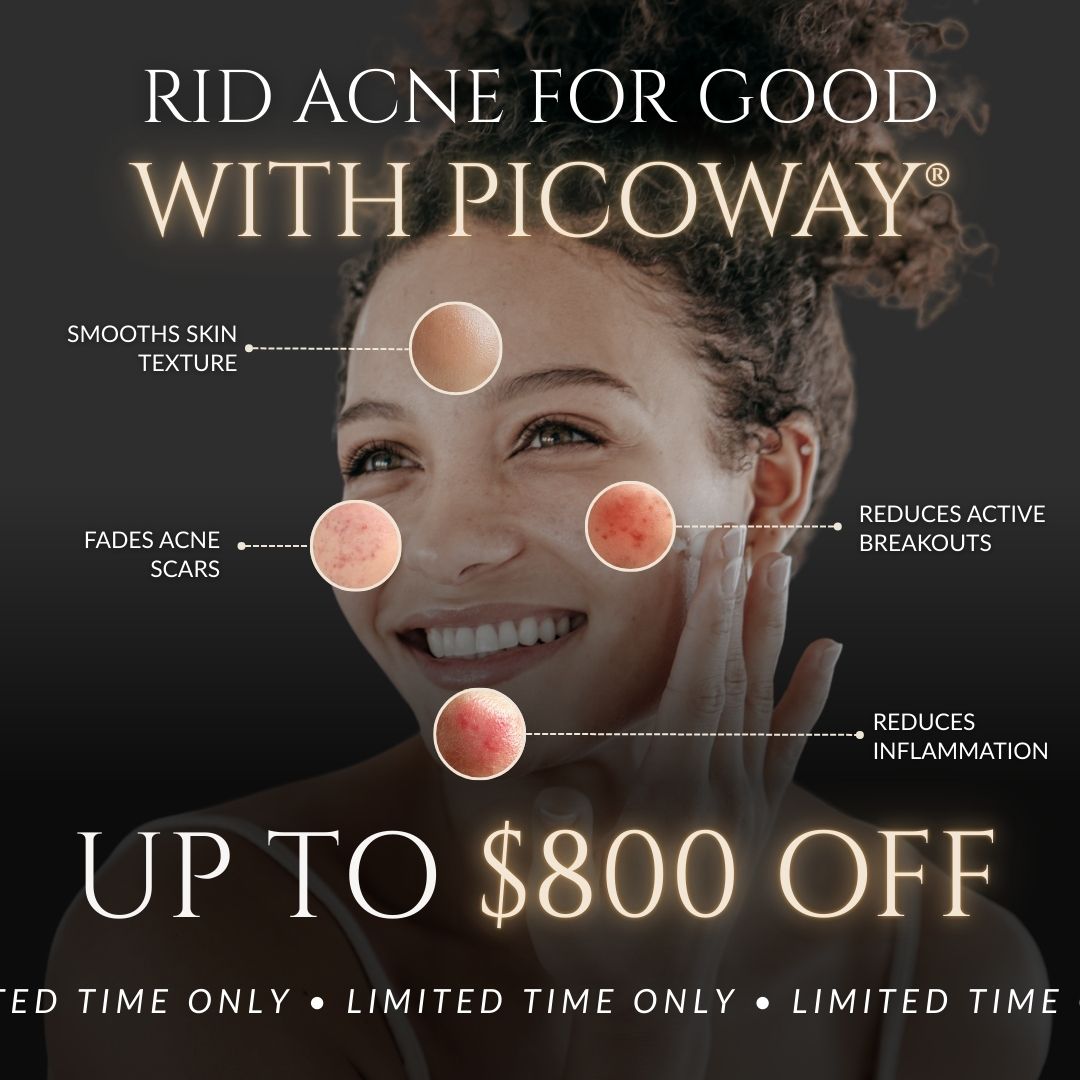 PicoWay® | Face Acne Treatments From $500
