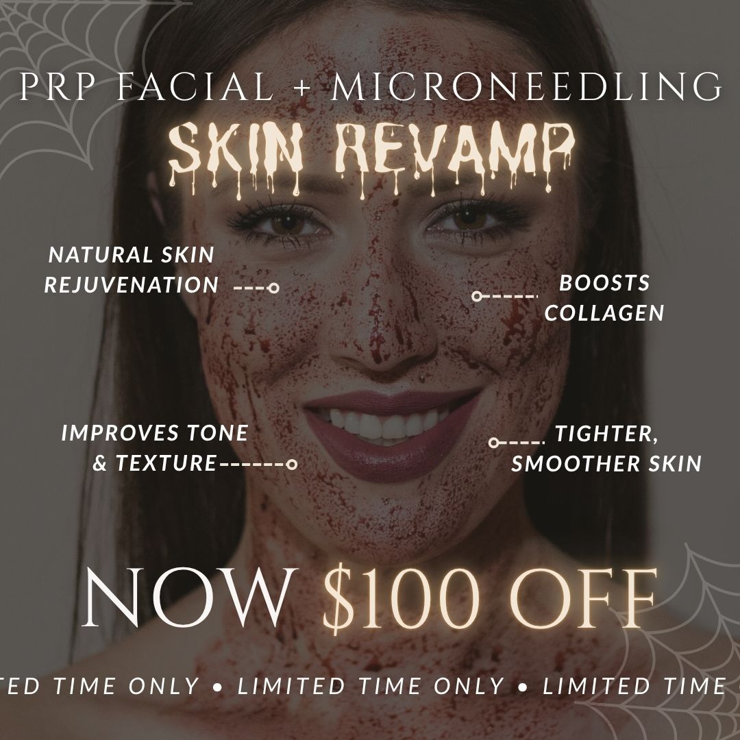 Skin ReVAMP | $100 OFF PRP Facial with Microneedling