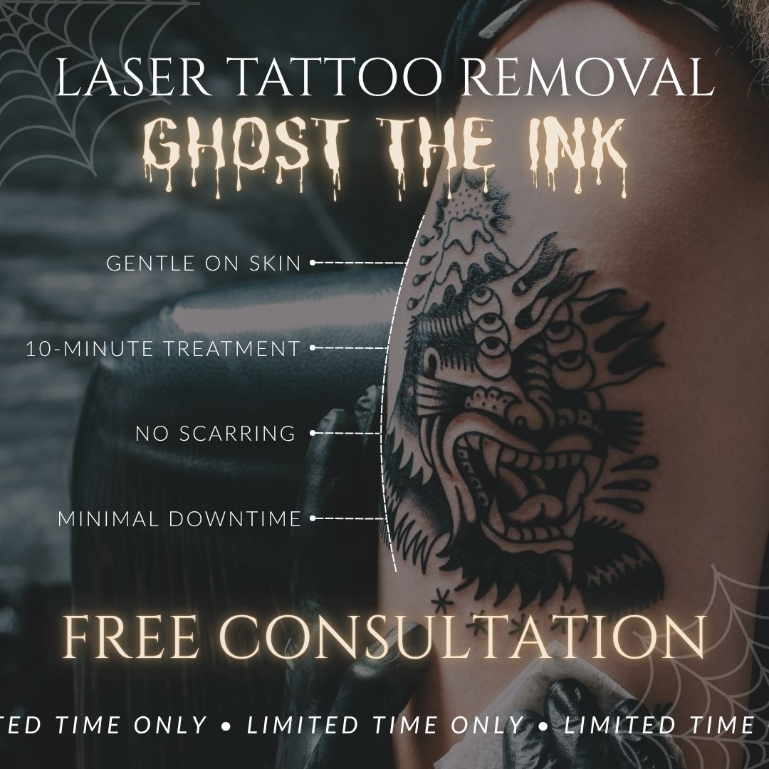 Ghost the Ink | FREE Laser Tattoo Removal Consultation