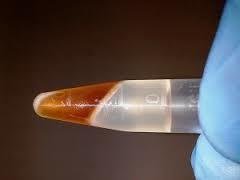 PHENOL CHLOROFORM ISOAMYL ALCOHOL SOLUTION 125:24:1 100 ml