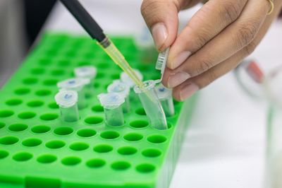 🧬 Molecular Biology