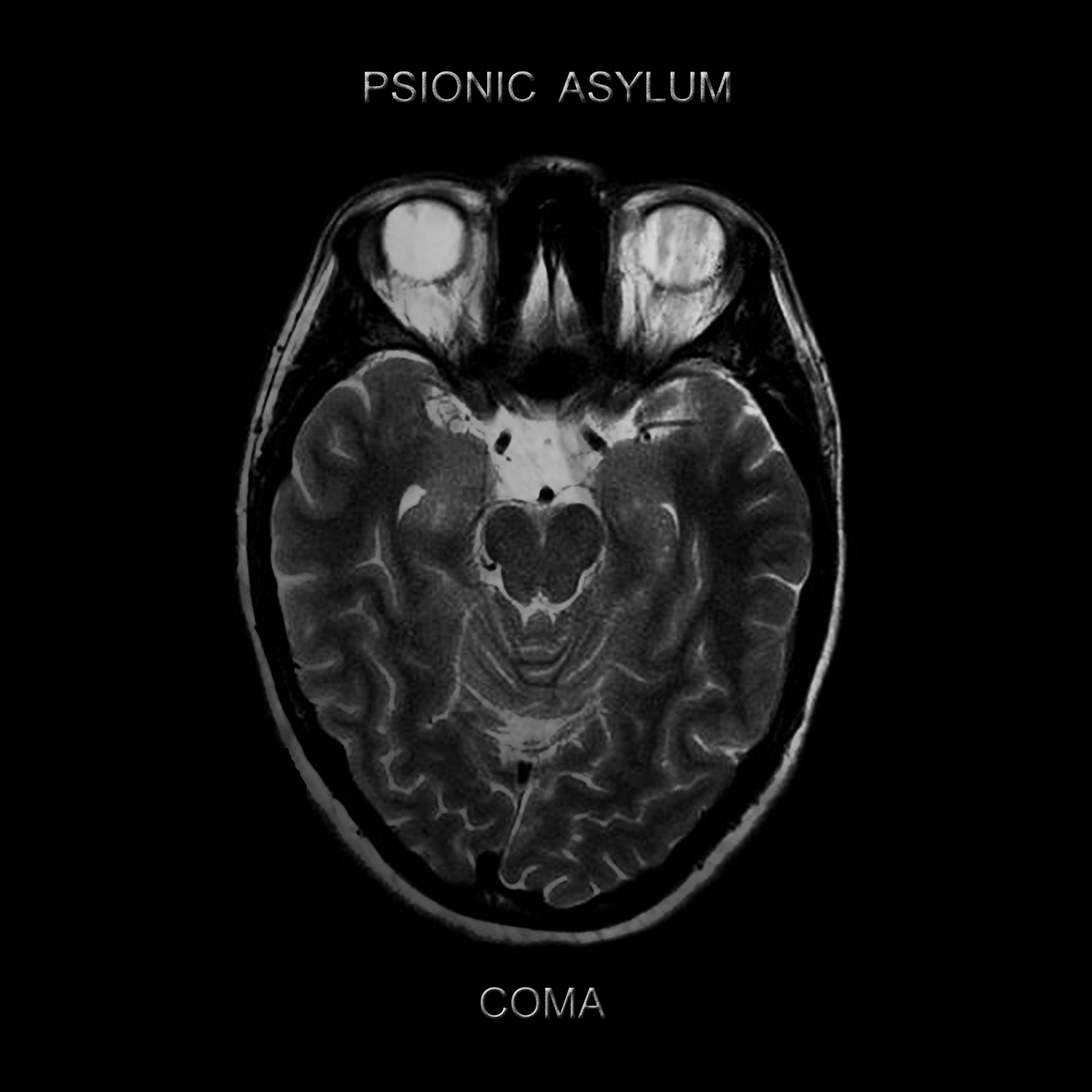 Psionic Asylum &quot;Coma&quot;