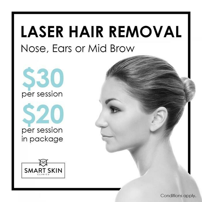 laser nose hair removal