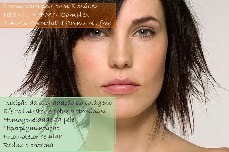 Creme para pele com Rosácea com Telangyn 2%; MDI Complex 2%; Aveia Coloidal 4% - Creme oil free Creme para pele com Rosácea com Telangyn 2%; MDI Complex 2%; Aveia Coloidal 4% - Creme oil free