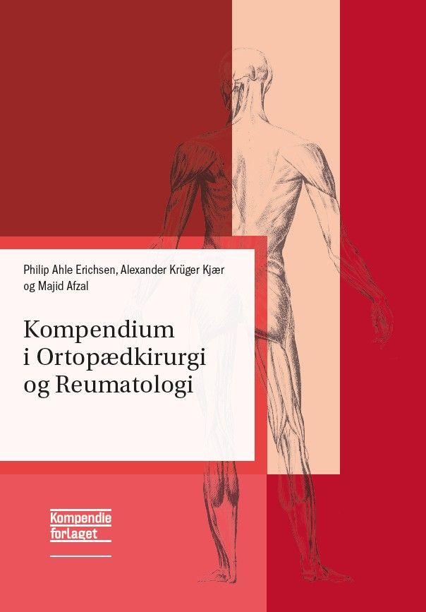 Kompendium i Ortopædkirurgi og Reumatologi
