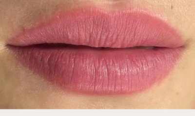 Nano lips