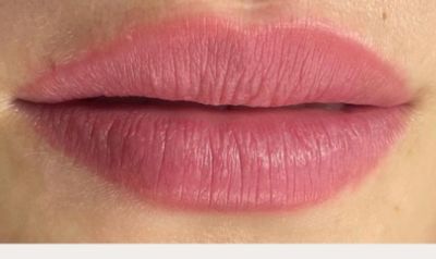 Nano lips